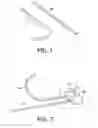 Fig. 02 - METHOD AND SYSTEM FOR CANNULA POSITIONING