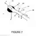 Fig. 08 - METHOD AND A DUAL-ARRAY TRANSDUCER PROBE FOR REAL TIME MECHANICAL IMAGING OF PROSTATE