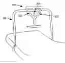 Fig. 01 - Methods and devices for assisting birth