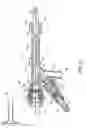 Fig. 04 - Direct stream hydrodynamic catheter system