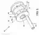 Fig. 06 - Direct stream hydrodynamic catheter system