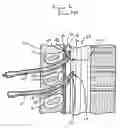 Fig. 02 - SPINAL NEEDLE LIGHT GUIDE APPARATUS AND METHOD OF DELIVERY