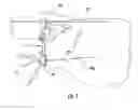 Fig. 02 - GUIDE PIN PLACEMENT FOR HIP RESURFACING