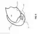 Fig. 07 - LIGAMENT RECONSTRUCTION GUIDE ASSEMBLY AND METHODS OF USE