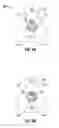 Fig. 07 - Apparatus and method for joining similar or dissimilar suture products