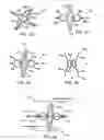 Fig. 09 - Device and method for establishing an artificial arterio-venous fistula