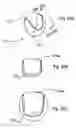 Fig. 09 - Bioerodible self-deployable intragastric implants
