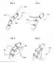 Fig. 02 - Bioerodible self-deployable intragastric implants and methods for use thereof
