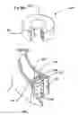 Fig. 16 - Bioerodible self-deployable intragastric implants and methods for use thereof
