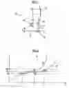 Fig. 02 - ELASTIC VENOUS COMPRESSION STOCKING THAT IS EASIER TO PUT ON