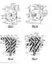 Fig. 06 - Percutaneous Puncture Sealing System