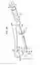 Fig. 12 - Suture anchor implantation instrumentation system