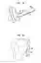 Fig. 13 - Suture anchor implantation instrumentation system