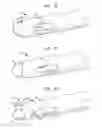 Fig. 07 - Suture anchor implantation instrumentation system