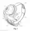 Fig. 02 - Fitting of brightness in a visual prosthesis