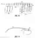 Fig. 07 - Remote sensing in an implantable medical device