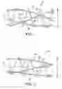 Fig. 02 - Tube with reverse necking properties