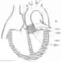 Fig. 01 - DEVICE AND METHOD FOR RESHAPING MITRAL VALVE ANNULUS