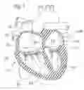 Fig. 02 - DEVICE AND METHOD FOR RESHAPING MITRAL VALVE ANNULUS
