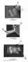 Fig. 07 - Systems and methods for forming patterned extracellular matrix materials