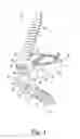 Fig. 02 - Combined spinal interbody and plate assemblies