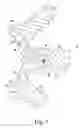 Fig. 06 - Combined spinal interbody and plate assemblies