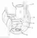 Fig. 01 - Augment For Use In A Knee Prelacement System And Method Of Performing A Knee Replacement Operation