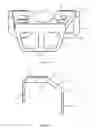 Fig. 02 - Augment For Use In A Knee Prelacement System And Method Of Performing A Knee Replacement Operation