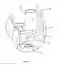 Fig. 04 - Augment For Use In A Knee Prelacement System And Method Of Performing A Knee Replacement Operation
