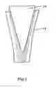 Fig. 02 - Hip joint prosthesis