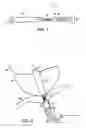 Fig. 02 - Treating urinary retention