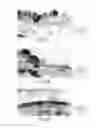Fig. 06 - Methods and compositions for detecting and treating retinal diseases based on metargidin (ADAM-15)