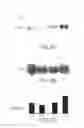 Fig. 07 - Methods and compositions for detecting and treating retinal diseases based on metargidin (ADAM-15)