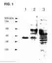 Fig. 02 - Use of regulatory sequences for specific, transient expression in neuronal determined cells