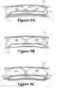 Fig. 15 - Ball glove incorporating a force attenuation system