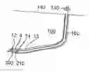Fig. 01 - Device for pressure testing of pipes