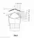 Fig. 06 - Saw blade including teeth having a chip deforming element