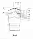 Fig. 07 - Saw blade including teeth having a chip deforming element