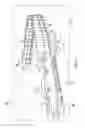 Fig. 02 - Mounting of drag reducing devices for stacked intermodal rail cars