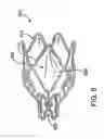 Fig. 07 - Bronchial flow control devices with membrane seal