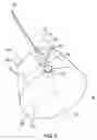 Fig. 03 - Wire untwisting tool