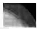 Fig. 01 - Diamond-enhanced cutting elements, earth-boring tools employing diamond-enhanced cutting elements, and methods of making diamond-enhanced cutting elements