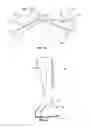 Fig. 04 - COLLAPSIBLE SAFE LADDER