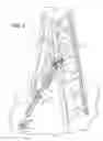 Fig. 02 - Stabilizer kit for providing reinforcing support to a ladder