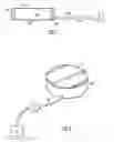 Fig. 02 - Moulding lenses