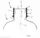 Fig. 03 - COMPRESSION MOULDING APPARATUSES AND METHODS