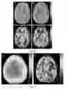 Fig. 09 - Interleaved single magnetic resonance sequence for MR quantification