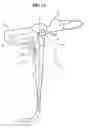 Fig. 29 - Endoscope system