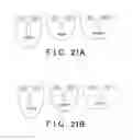Fig. 22 - Image processing system