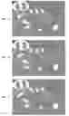 Fig. 08 - Reducing noise in an image